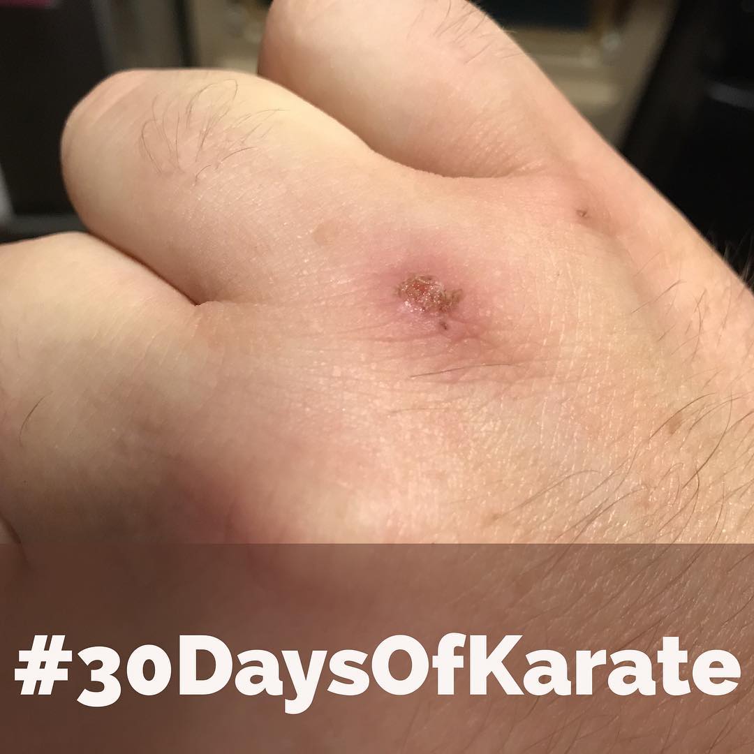 This is actually from yesterday’s #30daysofkarate (Day 20). It was spent in the #dojo again and, afterward, I was practicing a few combinations and managed to strike a brick wall. So, yeah… BRICKS DO HIT BACK! LOL. #karate #bushido #budo #practice #injury #booboo #martialarts #suckitupbuttercup @karateculture @erickastengren @jeremylesniak @mish.mash.do @jay_the_sensational @ando_mierzwa